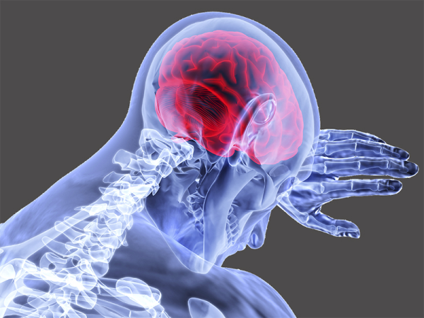 Stroke okai: Így befolyásolja a stroke rizikóját, hogy mennyire zajos környezetben élsz
