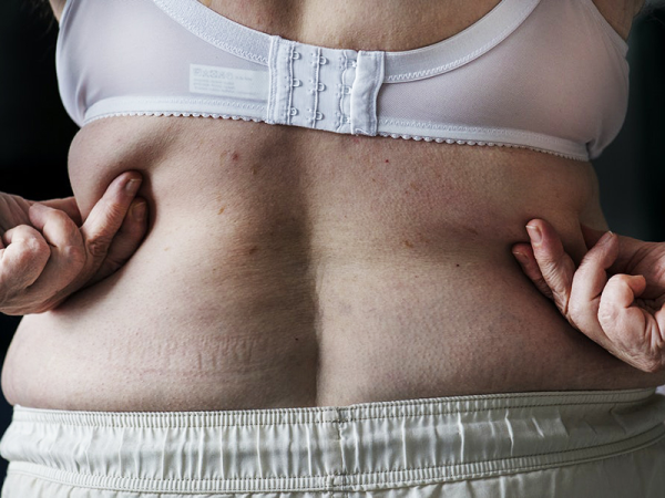 Az elhízás a korral jár, mert lassul az emésztés? - Óriási mítoszt döntött le egy kutatás, mely az anyagcserét vizsgálta babakortól időskorig